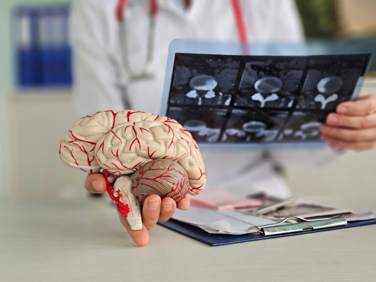 Doctor checks x-ray of brain using ST segment scanning. MRI of brain